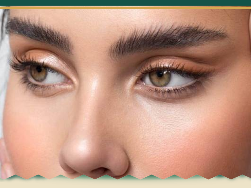 بوتاکس چشم گربه ای | مطب زیبایی کرج | دکتر قرایی